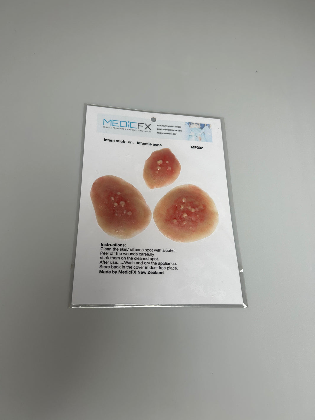 SALE- MP302 Infantile Acne