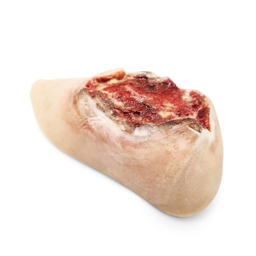 Electrical Burn Heel