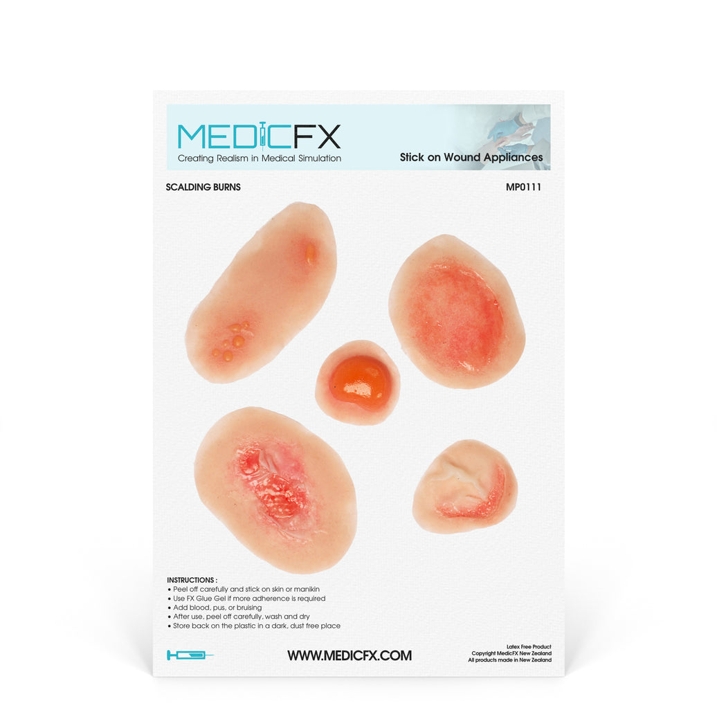 Sheet Scalding Burns