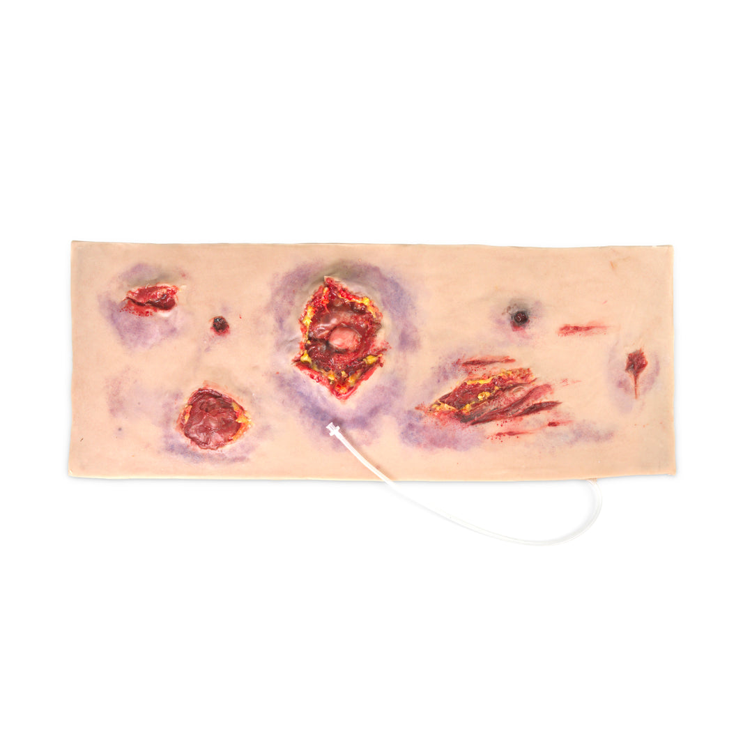 Multiple Abdominal Gun Shot Wounds (New)