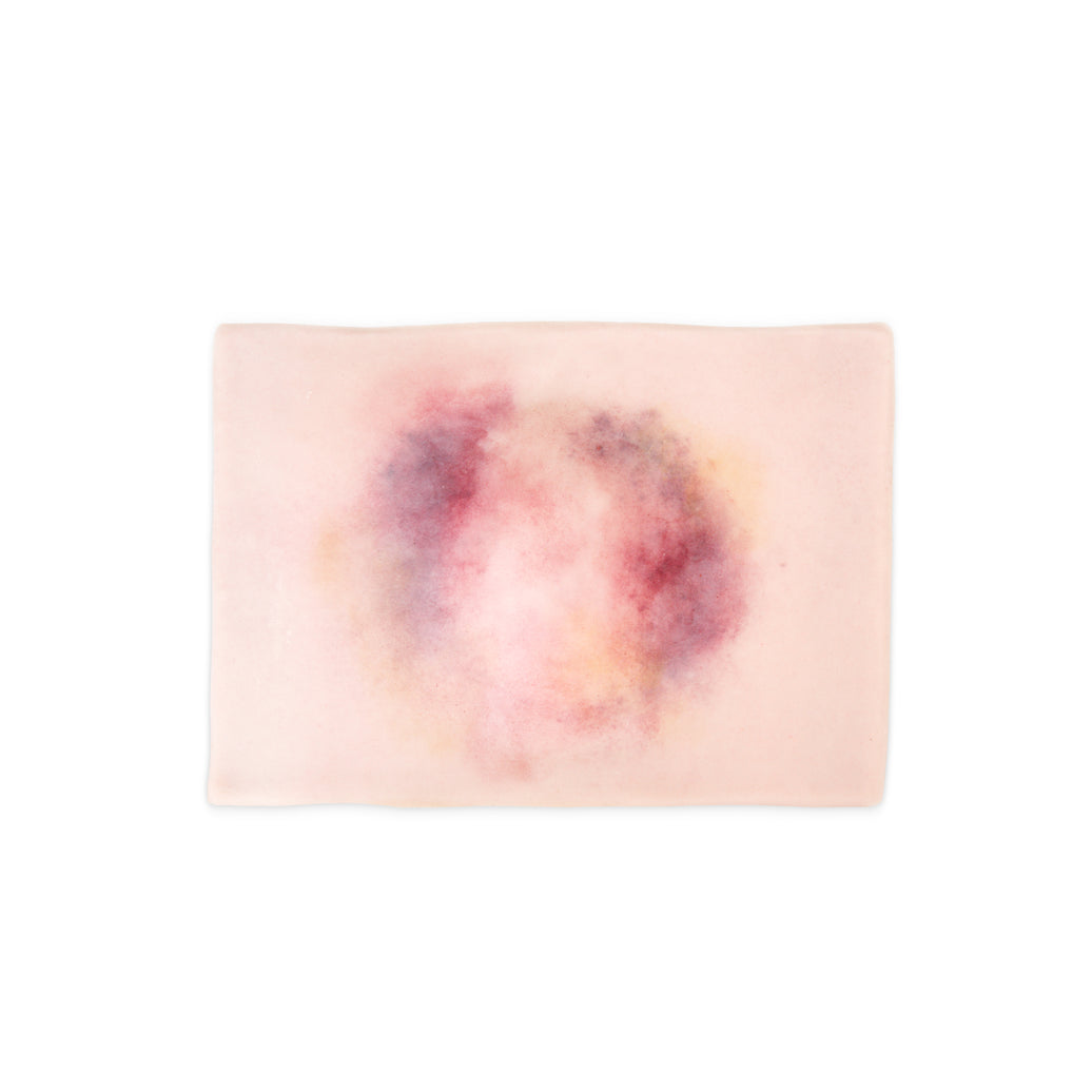 Femur Fracture Closed