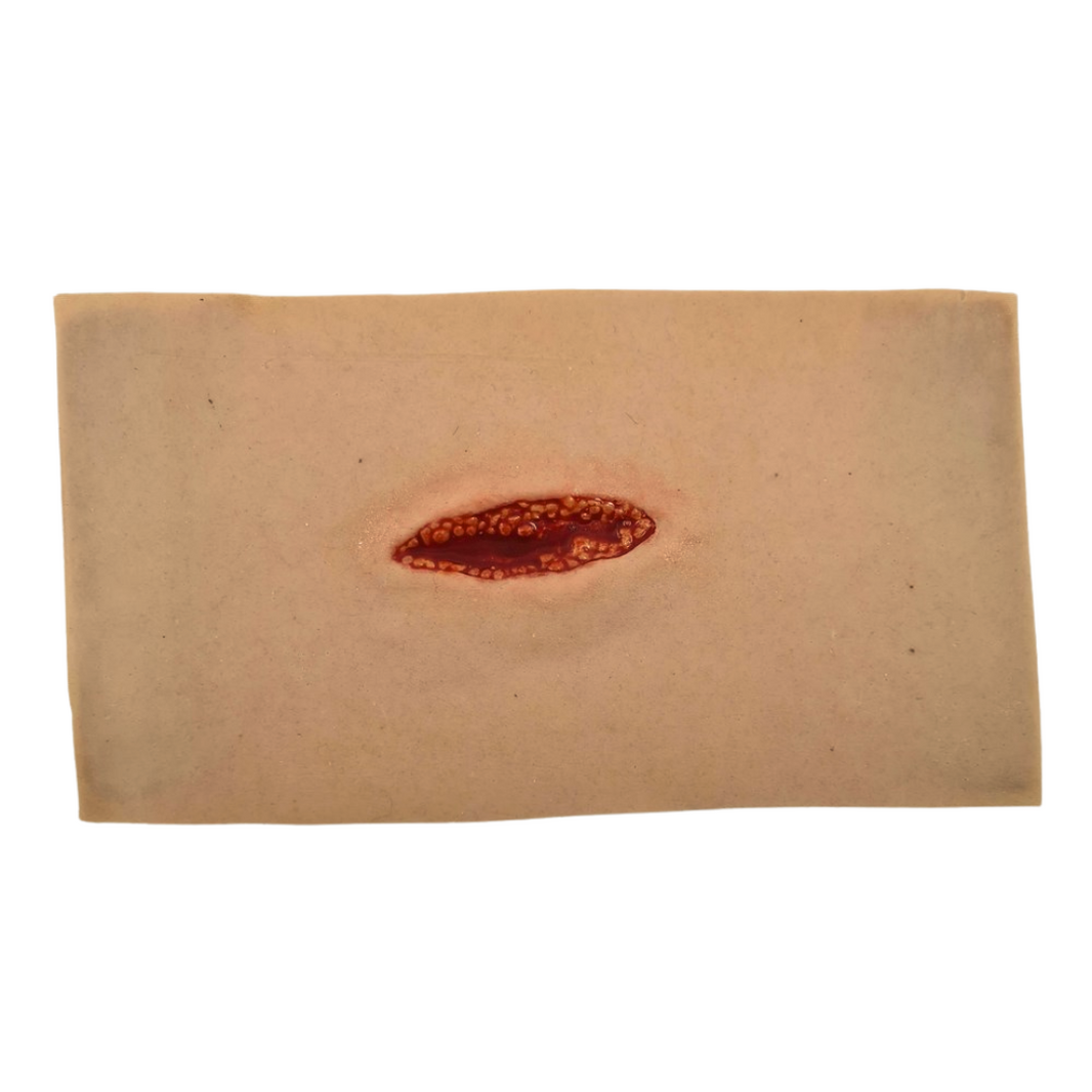 Small Laceration