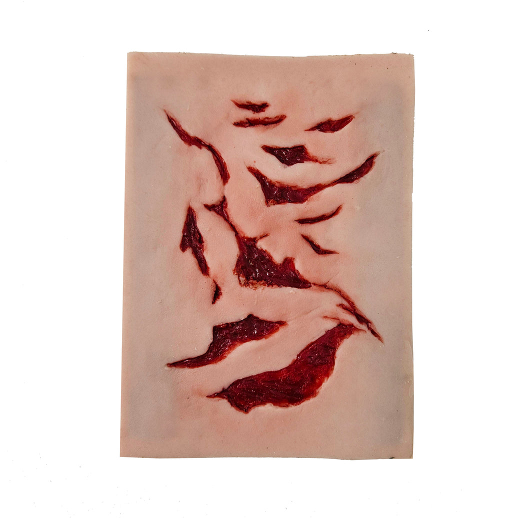 Multiple Lacerations