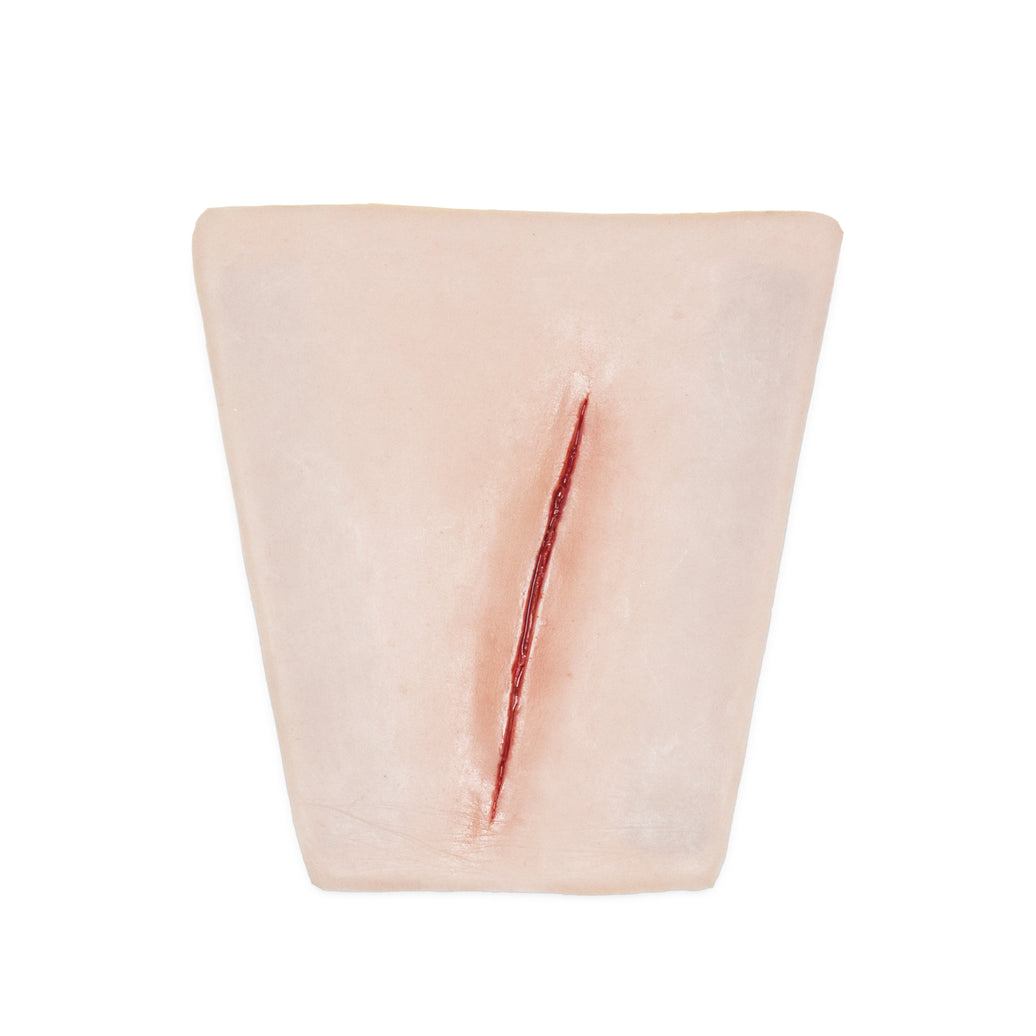 Suture Wrist laceration