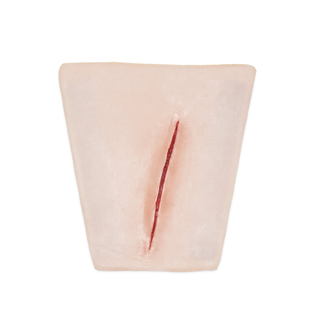 Suture Wrist laceration