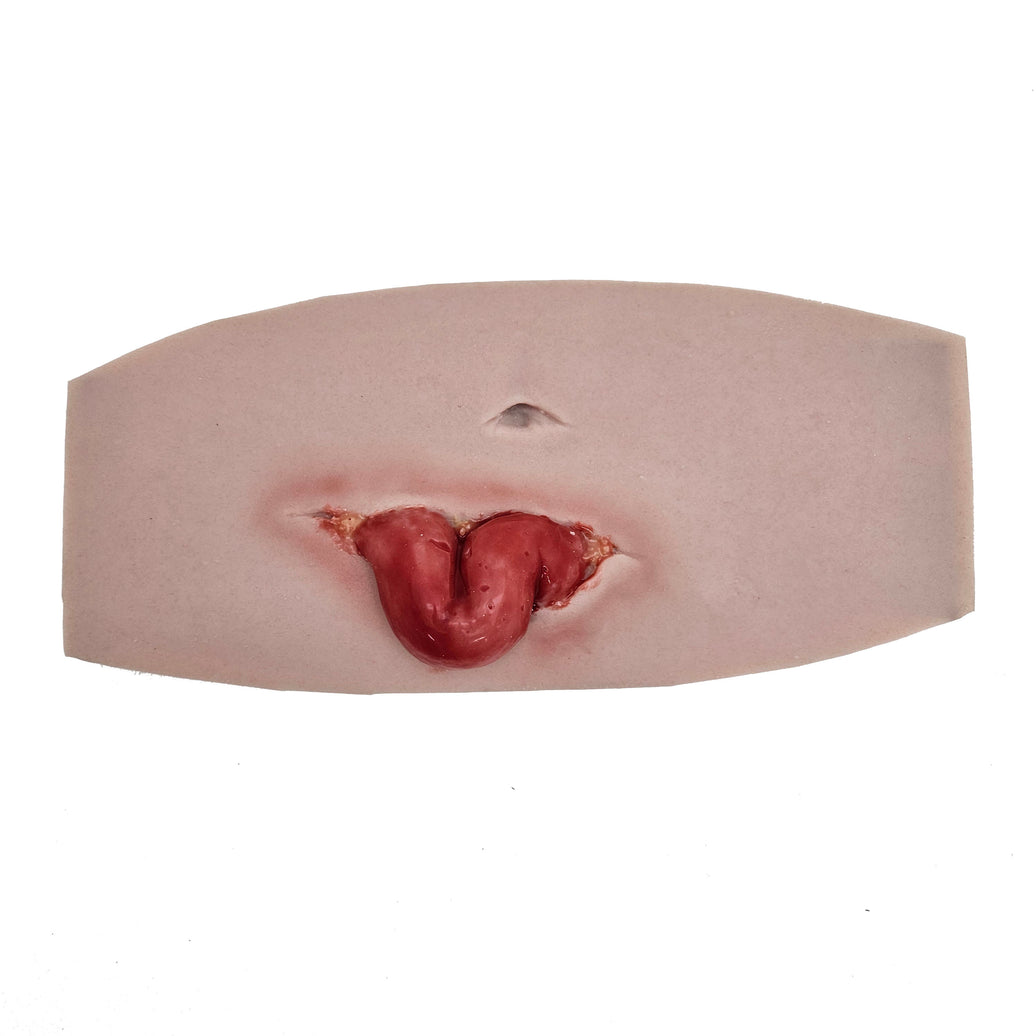 Eviscerated Abdomen small version