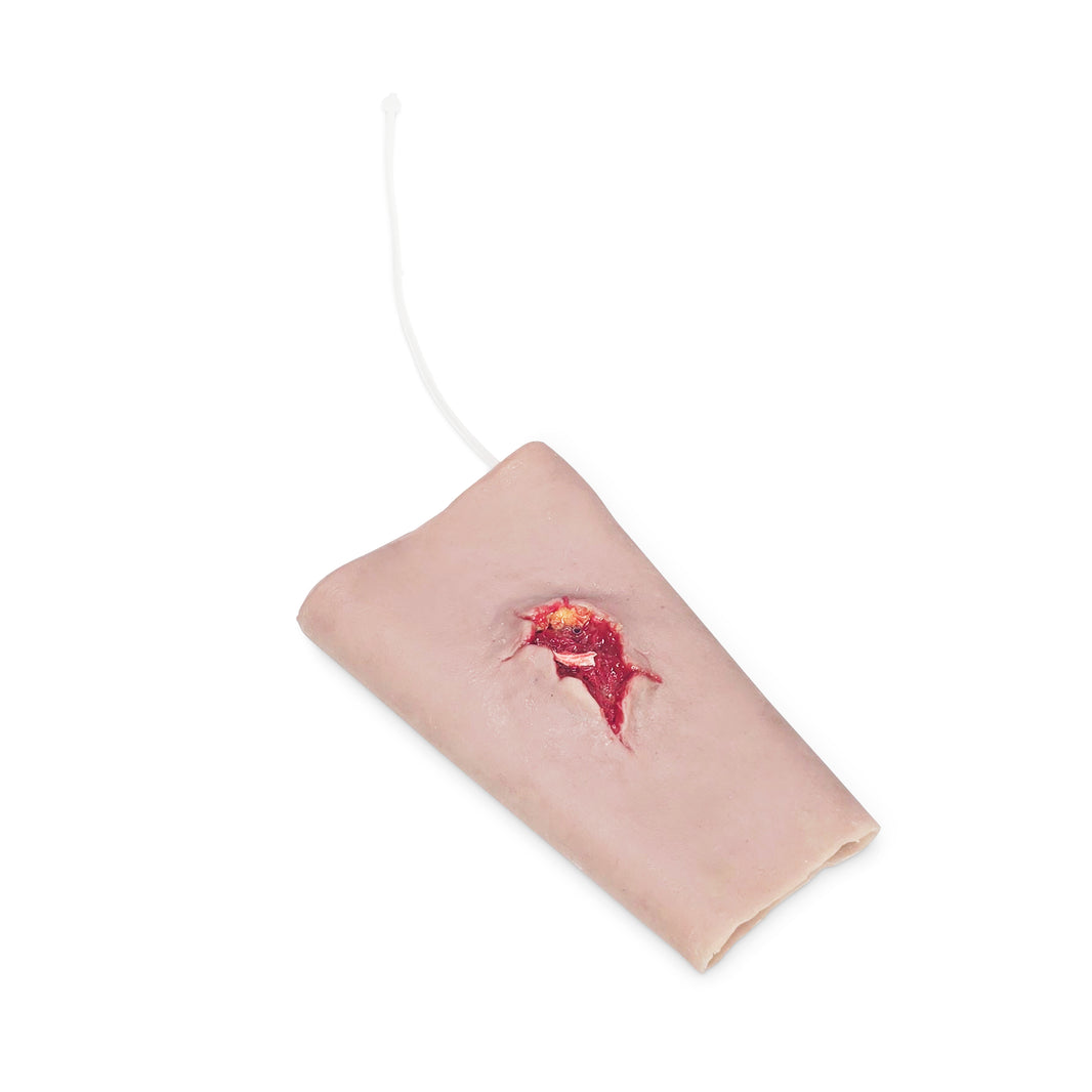Forearm Gun Shot Wound (New)