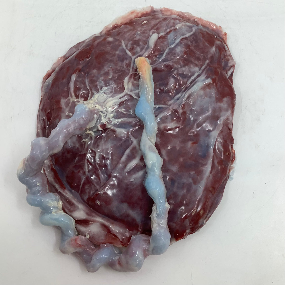 Full term Placenta And Umbilical Cord