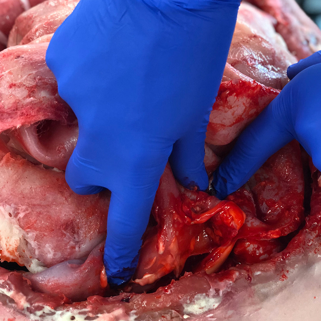 SURGICAL MODELS