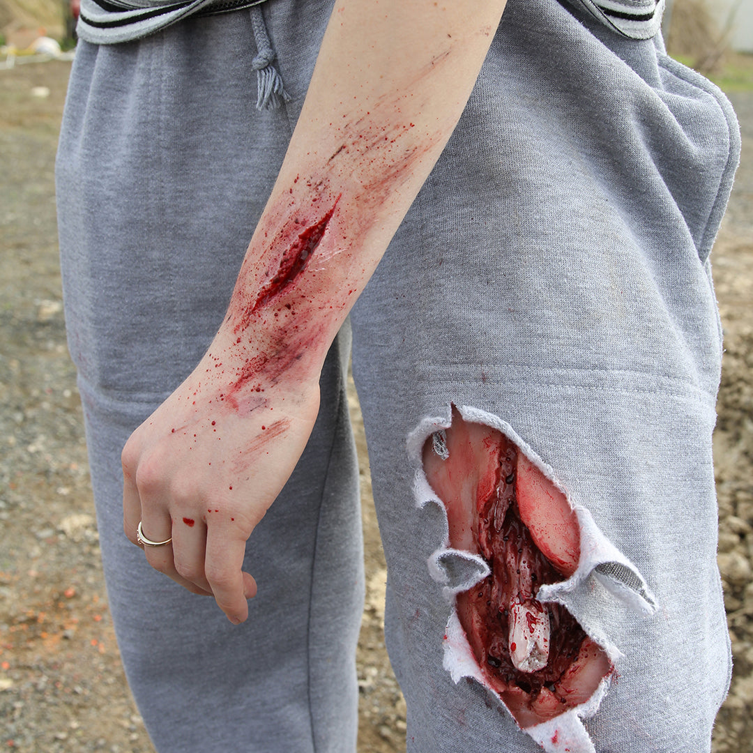 Trauma Training