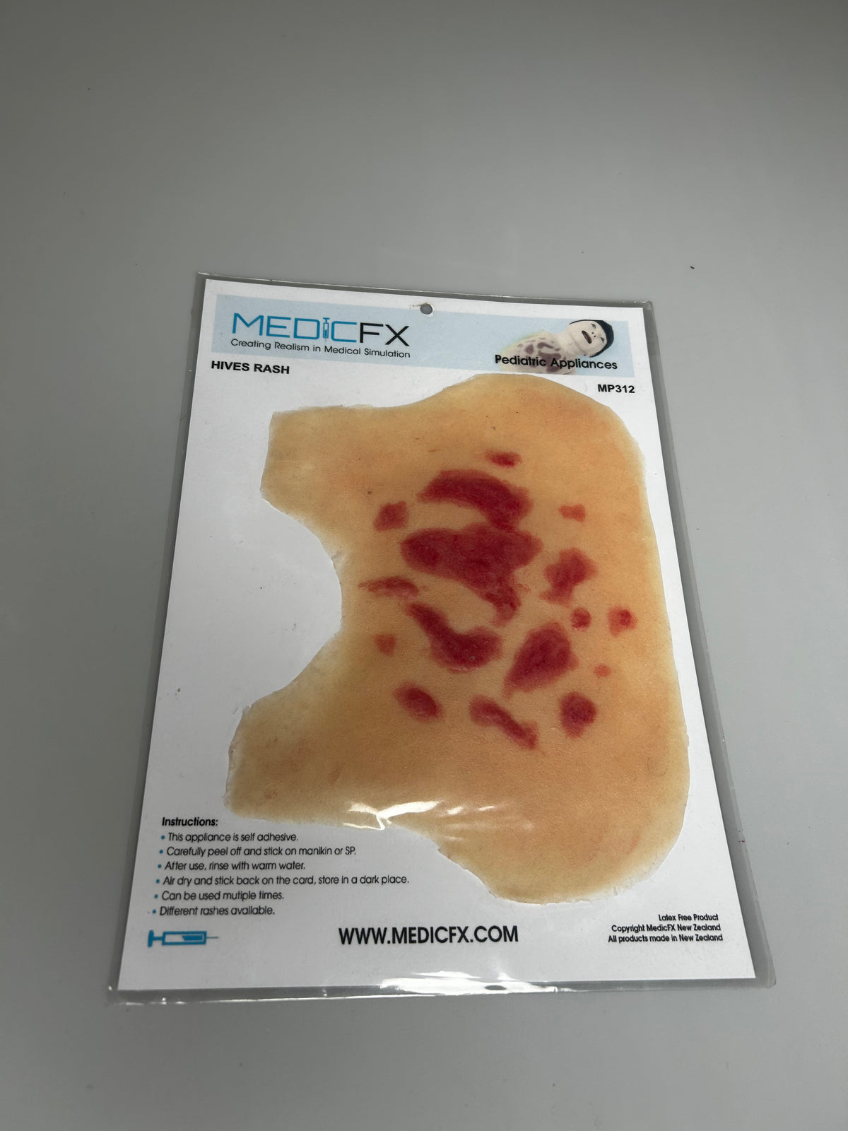 SALE- MP312 Hives rash