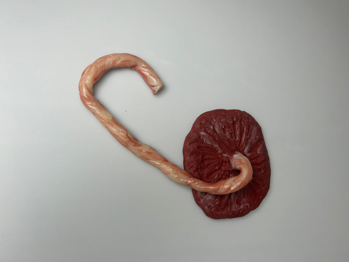 SALE- MO720 Placenta and Umbilical Cord