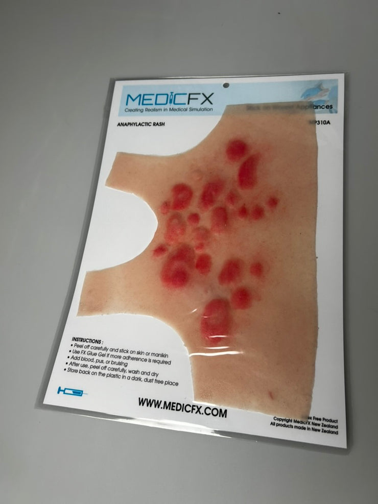 SALE- MP310A Anaphylactic Rash