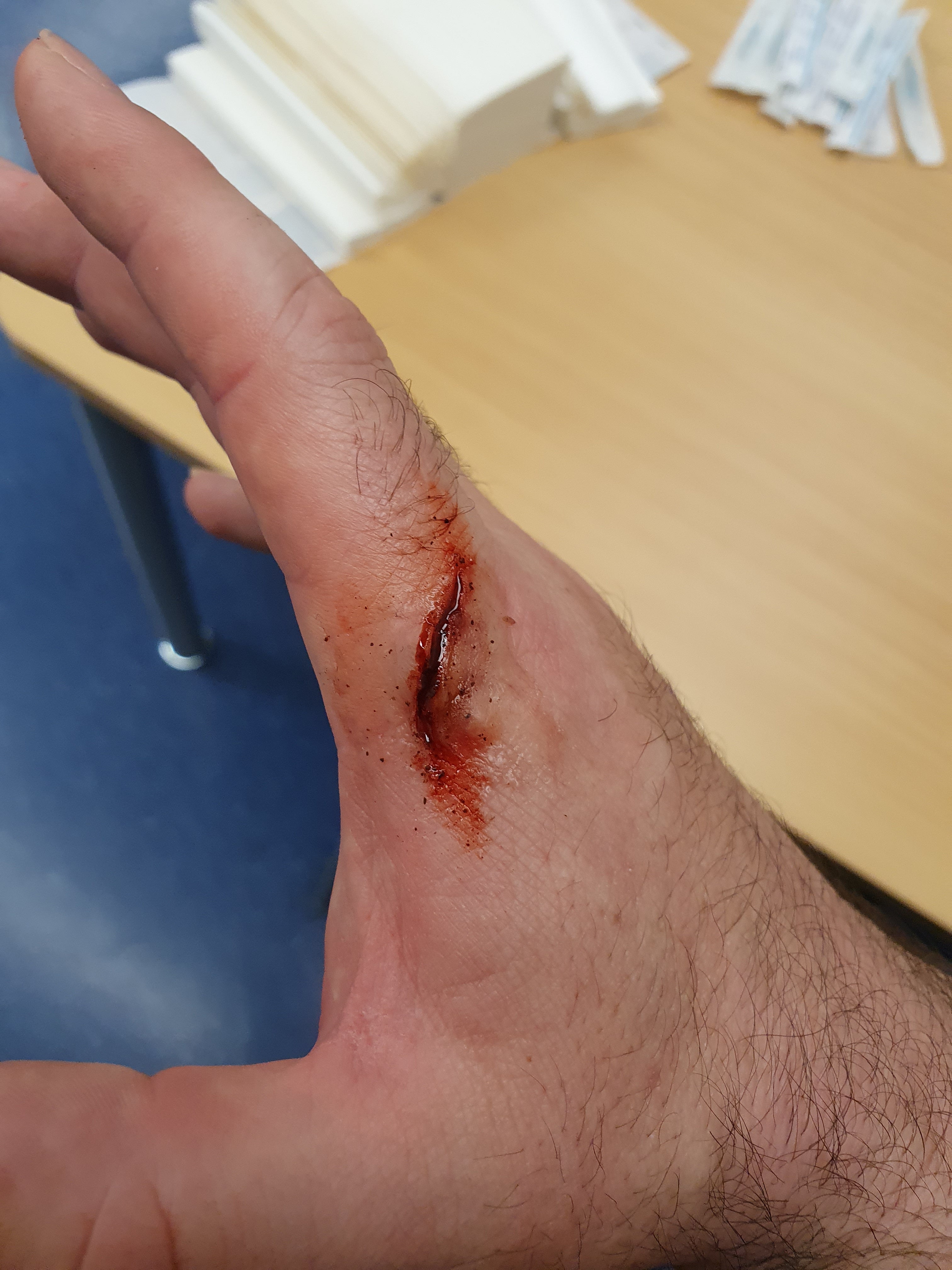 Moulage Training Course