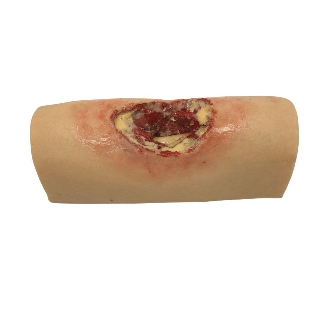 Deep Septic Training Stump