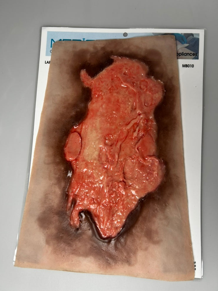 SALE- MB010 Large Burn