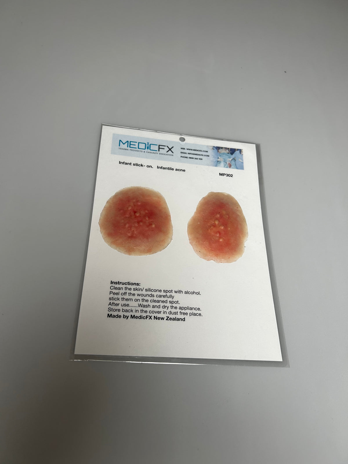 SALE- MP302 Infantile Acne