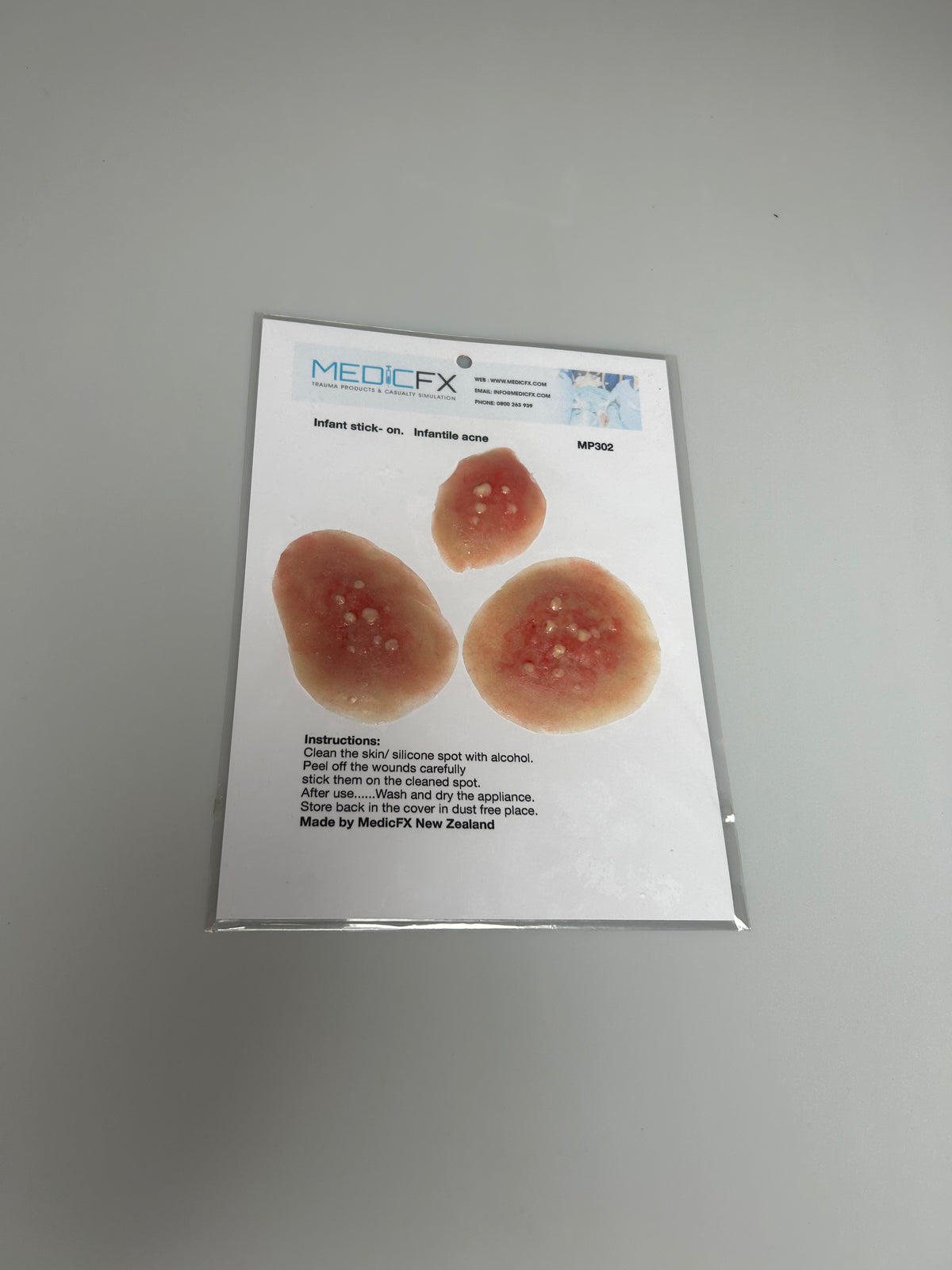 SALE- MP302 Infantile Acne