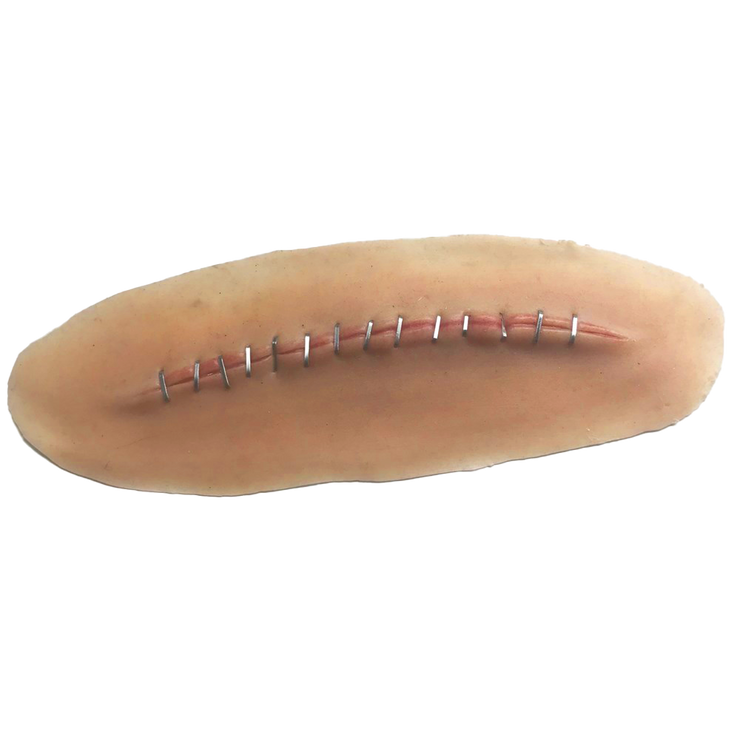 Stick-on C- section wound with staples