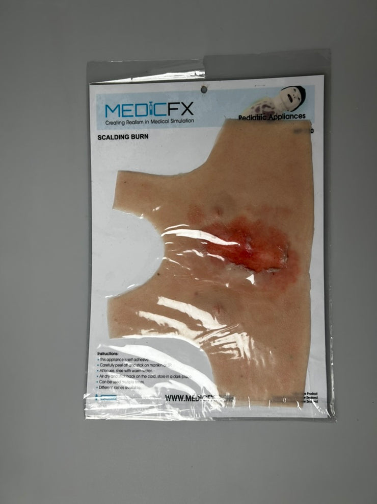 SALE- MP320 Scalding Burn