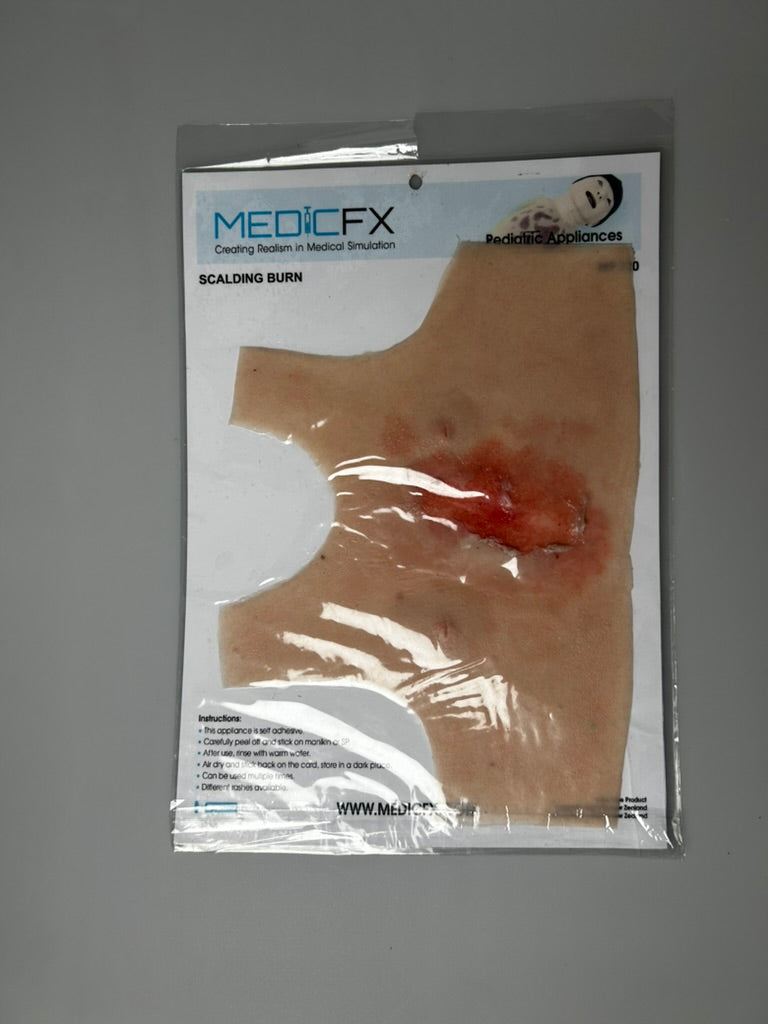 SALE- MP320 Scalding Burn