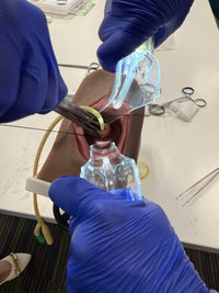 Cervical Cerclage Model