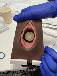 Cervical Cerclage Model