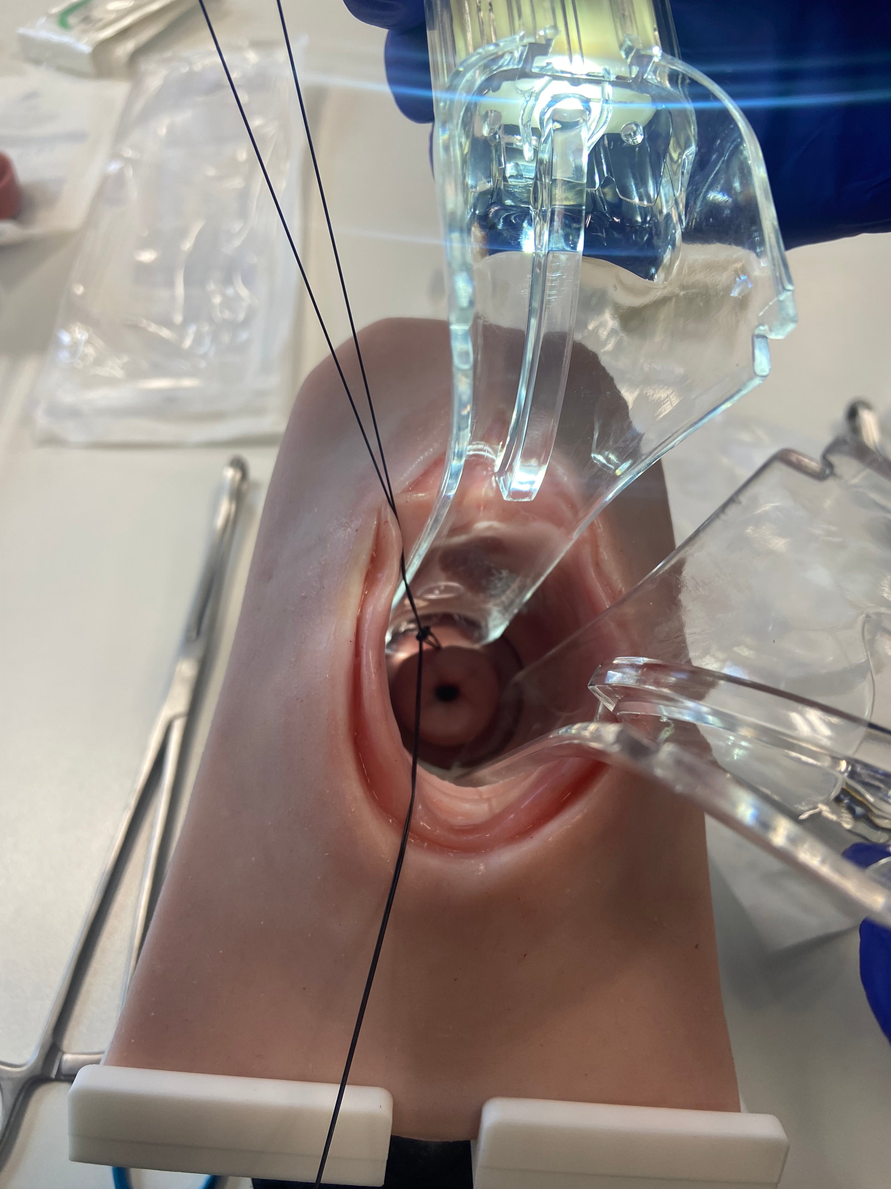 Cervical Cerclage Model