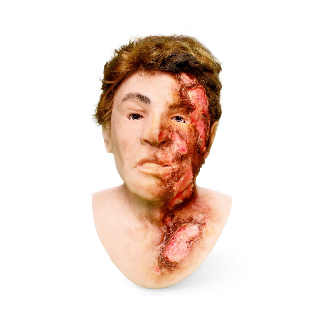 Luke Burned - SimMan Facial Overlay