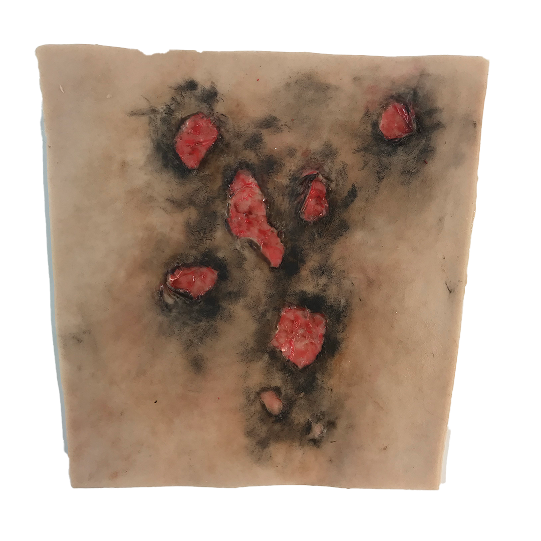 SIM - Burns package