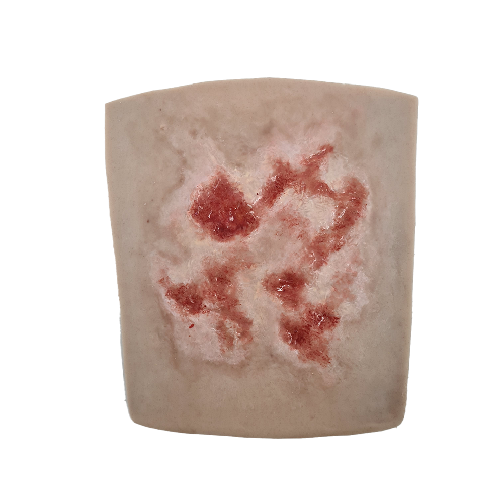 SIM/SKILLS - Home first aid injuries package