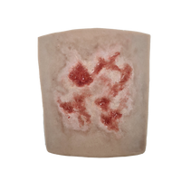 SKILLS - Skin and wound care tissue viability package