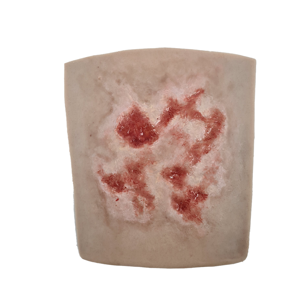 SKILLS - Skin and wound care tissue viability package