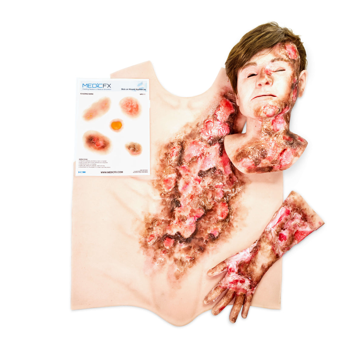Torso Burned