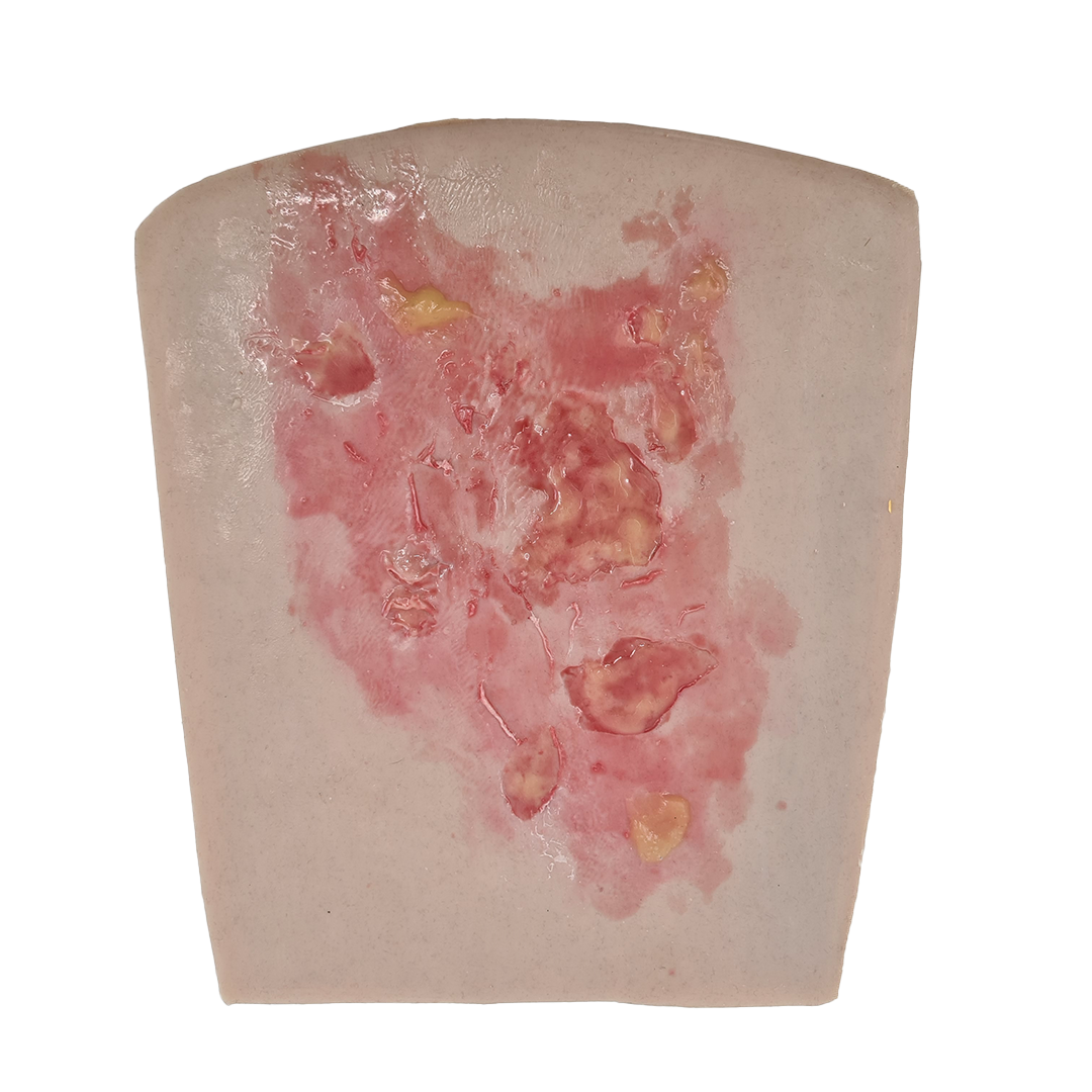 SKILLS - Pre-hospital work injuries package