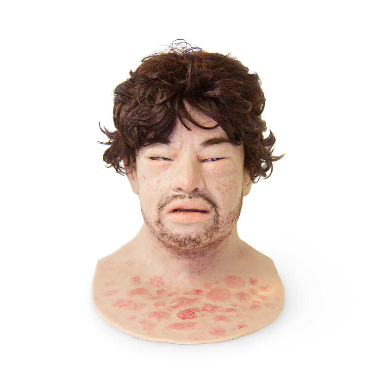 Eduardo Anaphylaxis SimMan Facial Overlay