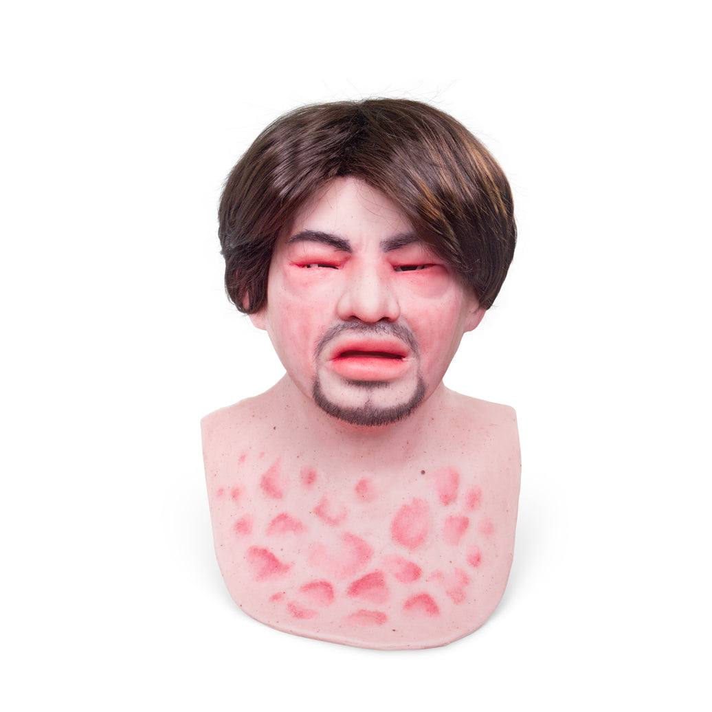 Eduardo Anaphylaxis SimMan Facial Overlay