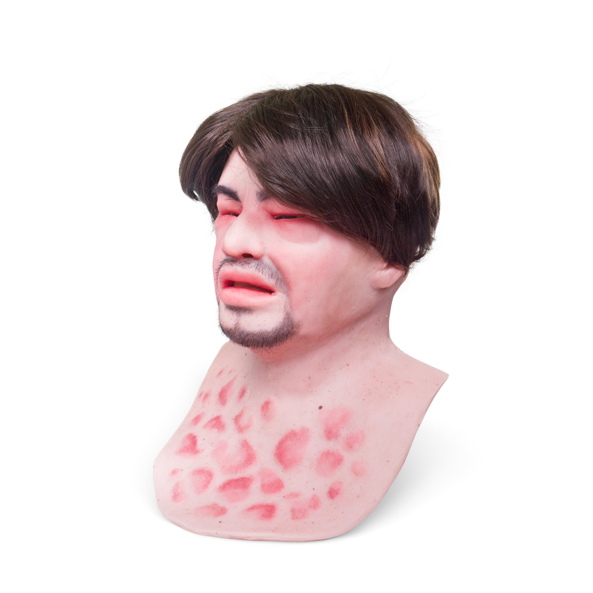 Eduardo Anaphylaxis SimMan Facial Overlay