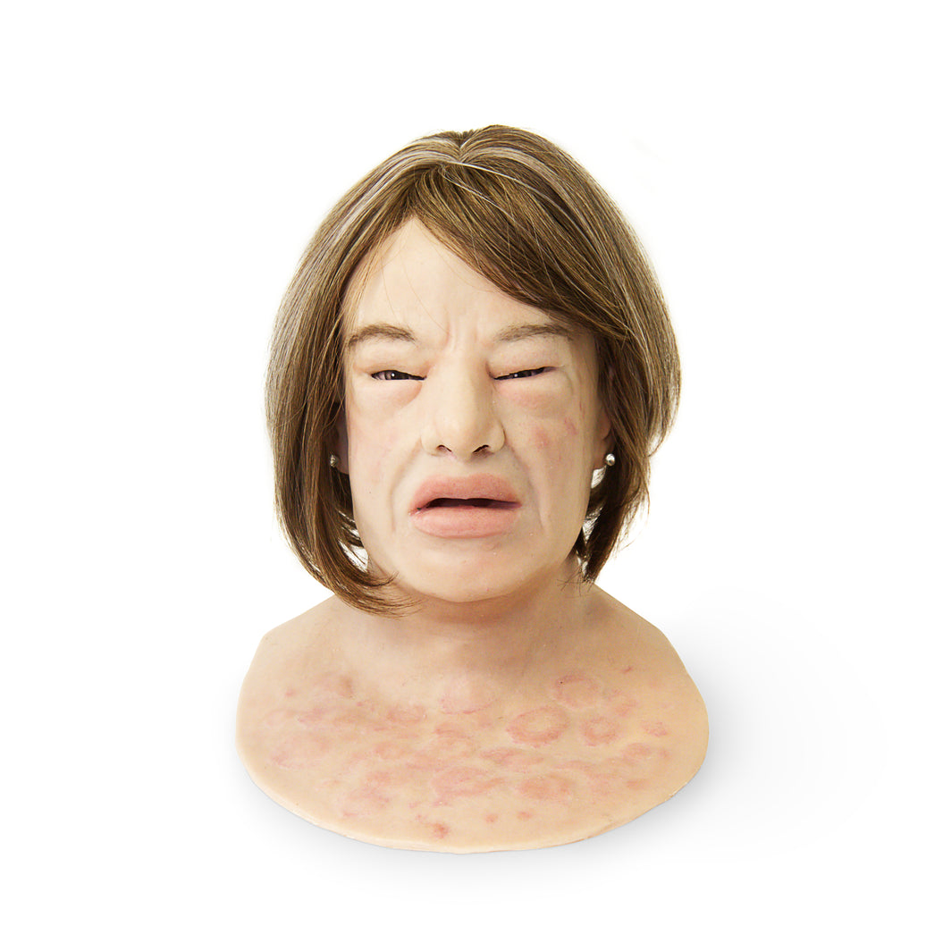 Erica Anaphylaxis SimMan Facial Overlay