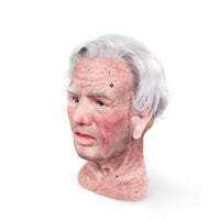 Rudie Sonneberg With Stroke - Gaumard Hal Facial Overlay
