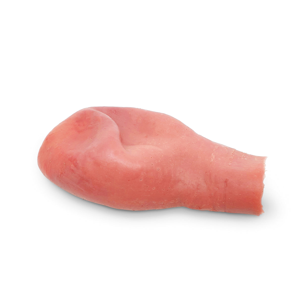 Uterus