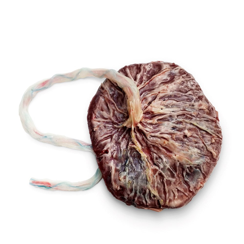 Full Term Placenta And Umbilical Cord