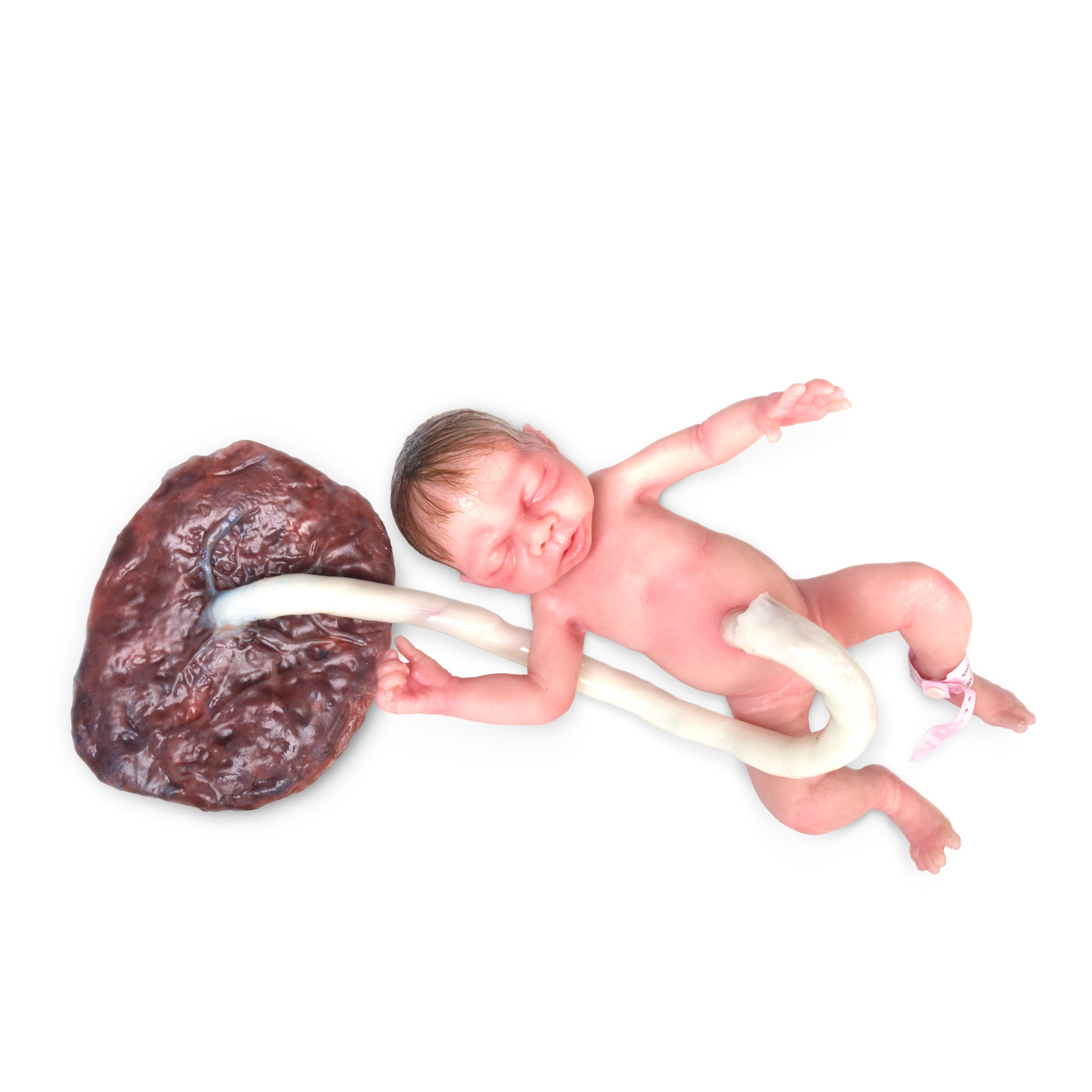 Baby Lara preemie birthing baby