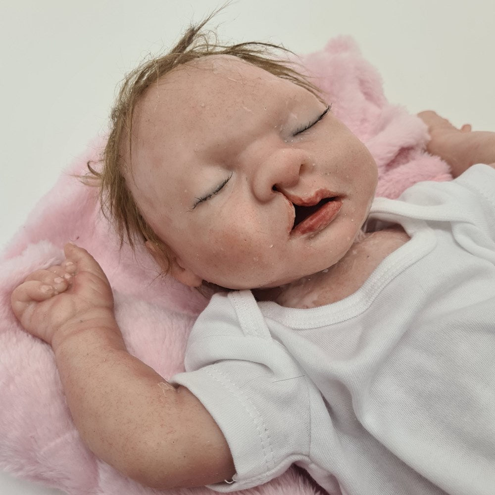 Baby Nina with cleft lip
