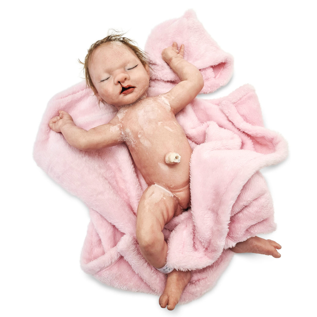 Baby Nina with cleft lip