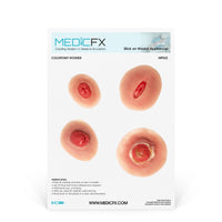 Sheet Colostomy