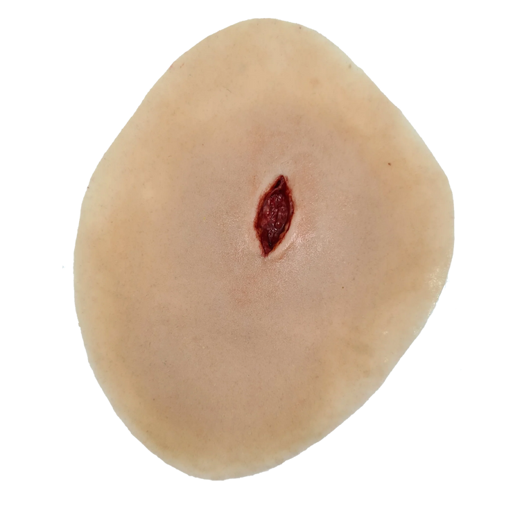 Sucking chest wound