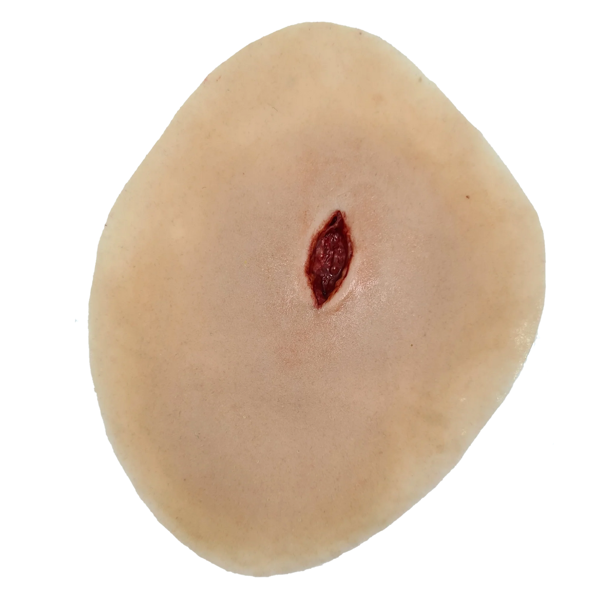 Sucking chest wound
