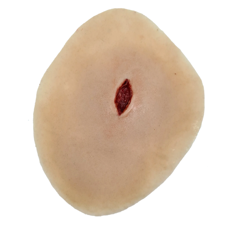 Sucking chest wound