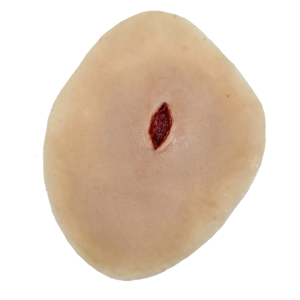 Sucking chest wound
